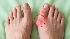 Povedzme „zbohom“ kostičkám na nohách: 6 cvičení, ktoré zároveň uvoľnia chodidlá